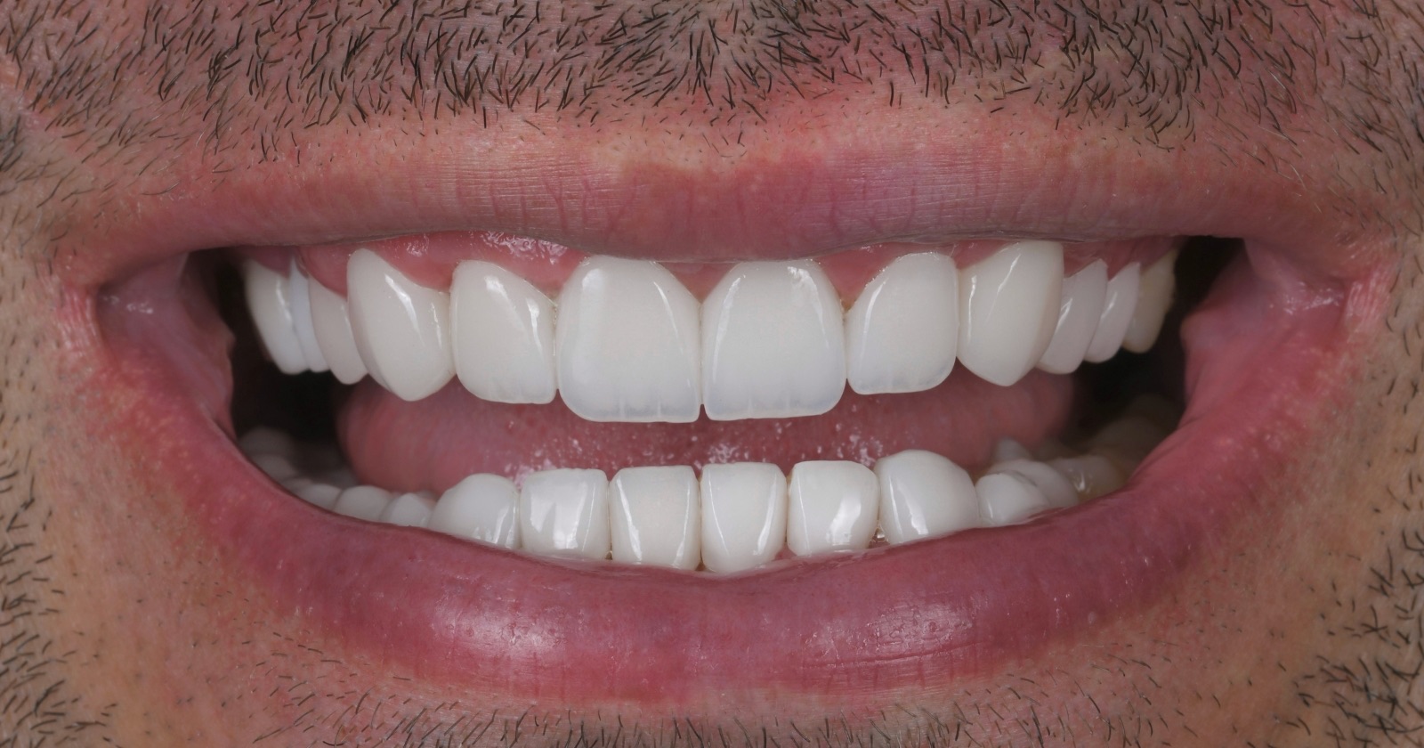 After treatment
